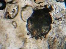 Video of the Sarcoptes scabiei mite.