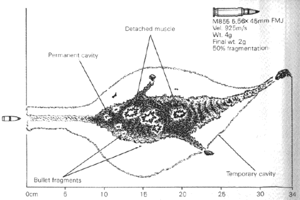 M16A2 M855 5.56×45mm NATO wound ballistics