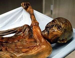 Ötzi the Iceman on a sheet-covered autopsy table